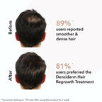 Professional O3+ Men Densiderm Hair Growth Scalp Serum Spray For Anti Hair Loss With Ginseng | Grocsy