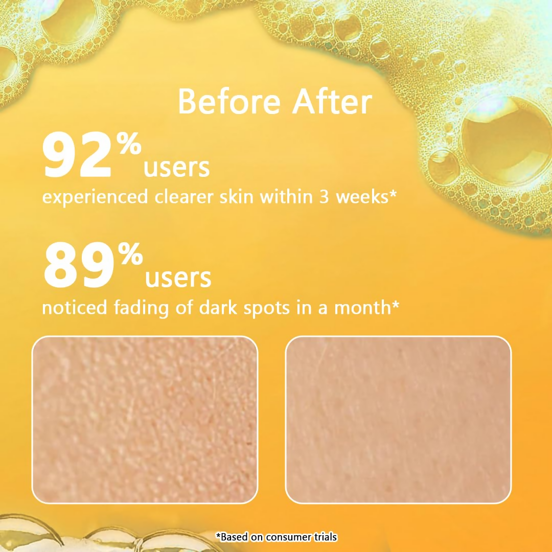 Milky Moon Vitamin C Face Wash for Brightening Face Cleanser | Grocsy