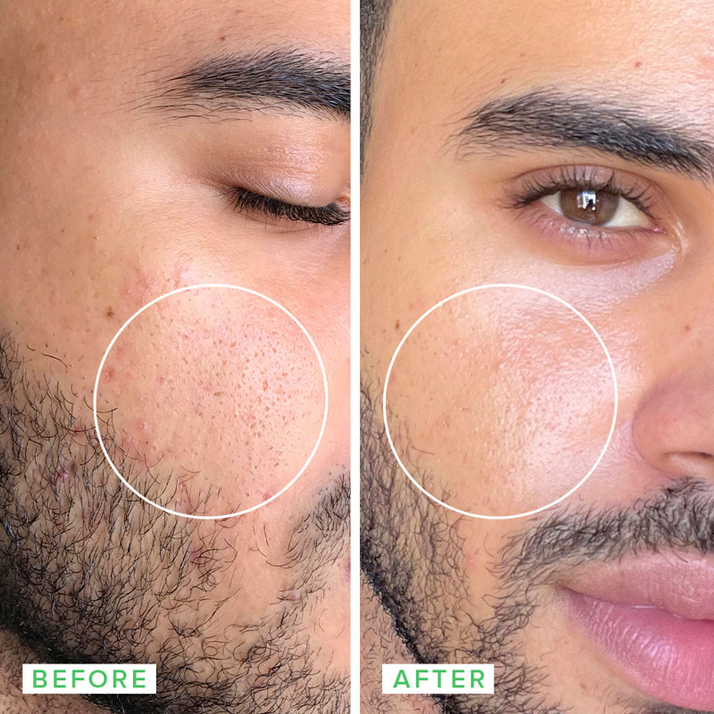 Farmacy Beauty Deep Sweep 2% BHA Pore Cleaning Toner With Salicylic Acid & Moringa Water | Grocsy