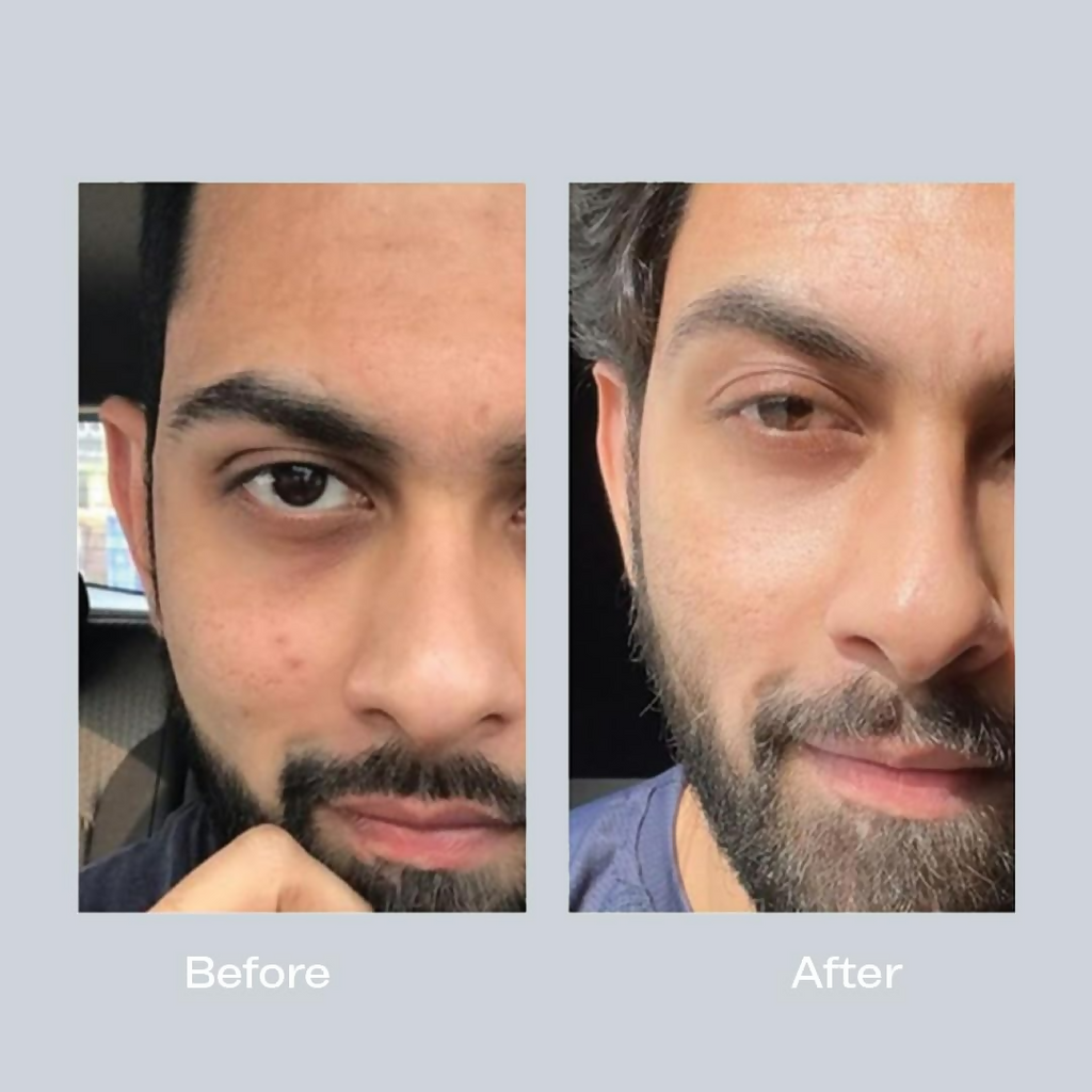 3 AM Vitamin C Serum For Uneven Skin | Grocsy