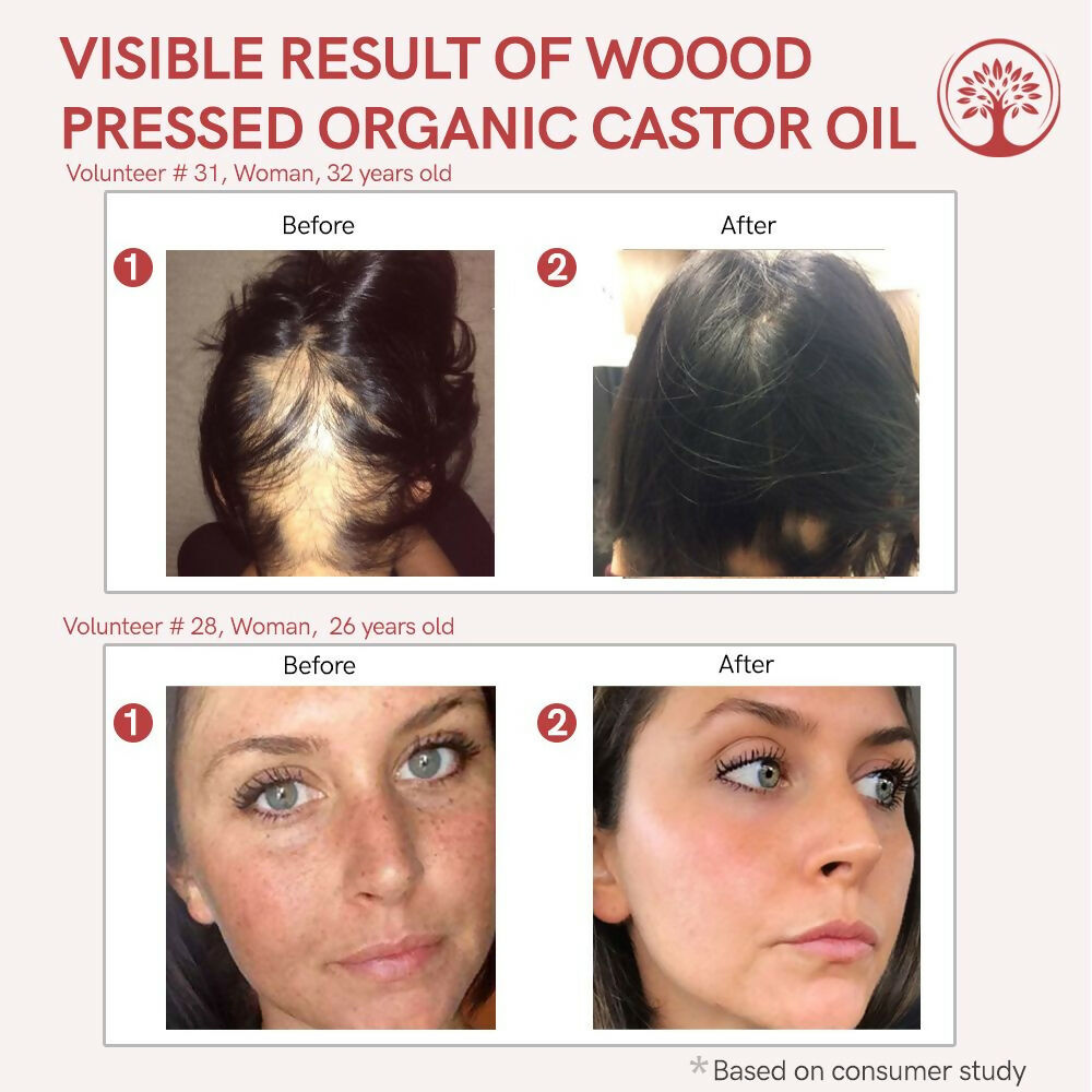 Ivory Natural Wood Pressed Organic Castor Oil For Healthy Skin & Hair Wellness | Grocsy