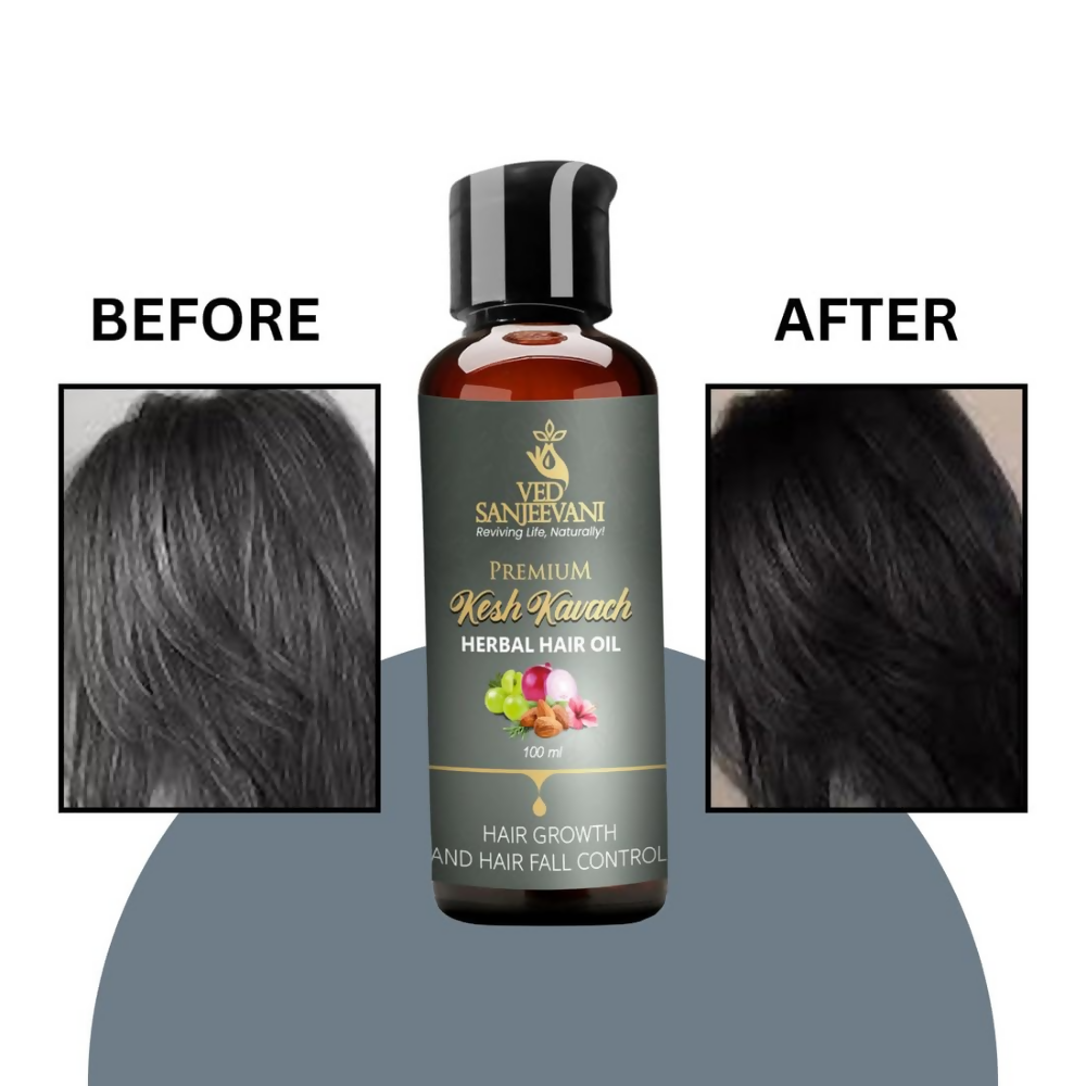 Ved Sanjeevani Kesh Kavach Herbal Hair Oil | Grocsy