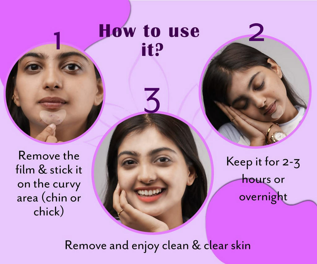 Urban Yog Acne Pimple Patch - Invisible Facial Stickers Cover With 100% Hydrocolloid | Grocsy
