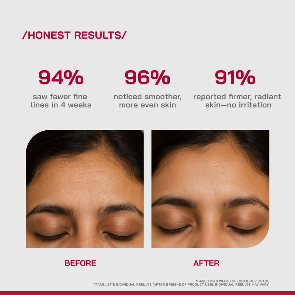 Proven Honest Derma (PHD) 0.3% Retinol Serum With Bakuchiol & Peptides | Grocsy