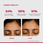 Proven Honest Derma (PHD) 0.3% Retinol Serum With Bakuchiol & Peptides | Grocsy