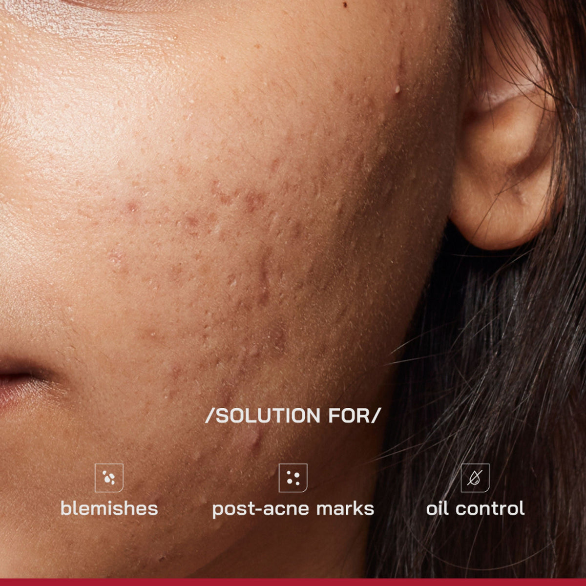 Proven Honest Derma (PHD) 10% Niacinamide Spot Correcting Serum | Grocsy