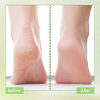 Nykaa Skin Happy Heels 20%Urea, 2%Lactic Acid Foot Cream-Dry & Cracked Feet - Tea Tree & Aloe Vera | Grocsy