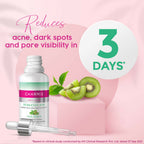 Charmis Anti Acne 2% Salicylic Acid Face Serum with Green Tea & Kiwi Extracts for Clear & Glowing Skin | Grocsy