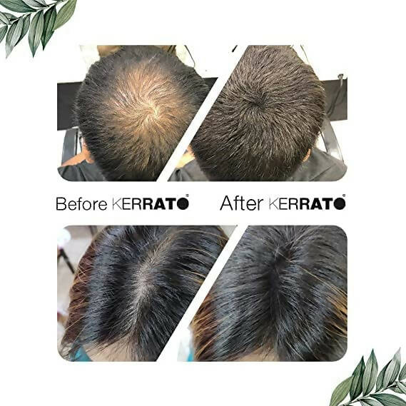 Kerrato Hair Fibres For Thinning Hair - Jet Black | Grocsy