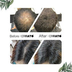 Kerrato Hair Fibres For Thinning Hair - Jet Black | Grocsy