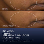 Estee Lauder Advanced Night Repair Synchronized Multi-Recovery Complex | Grocsy