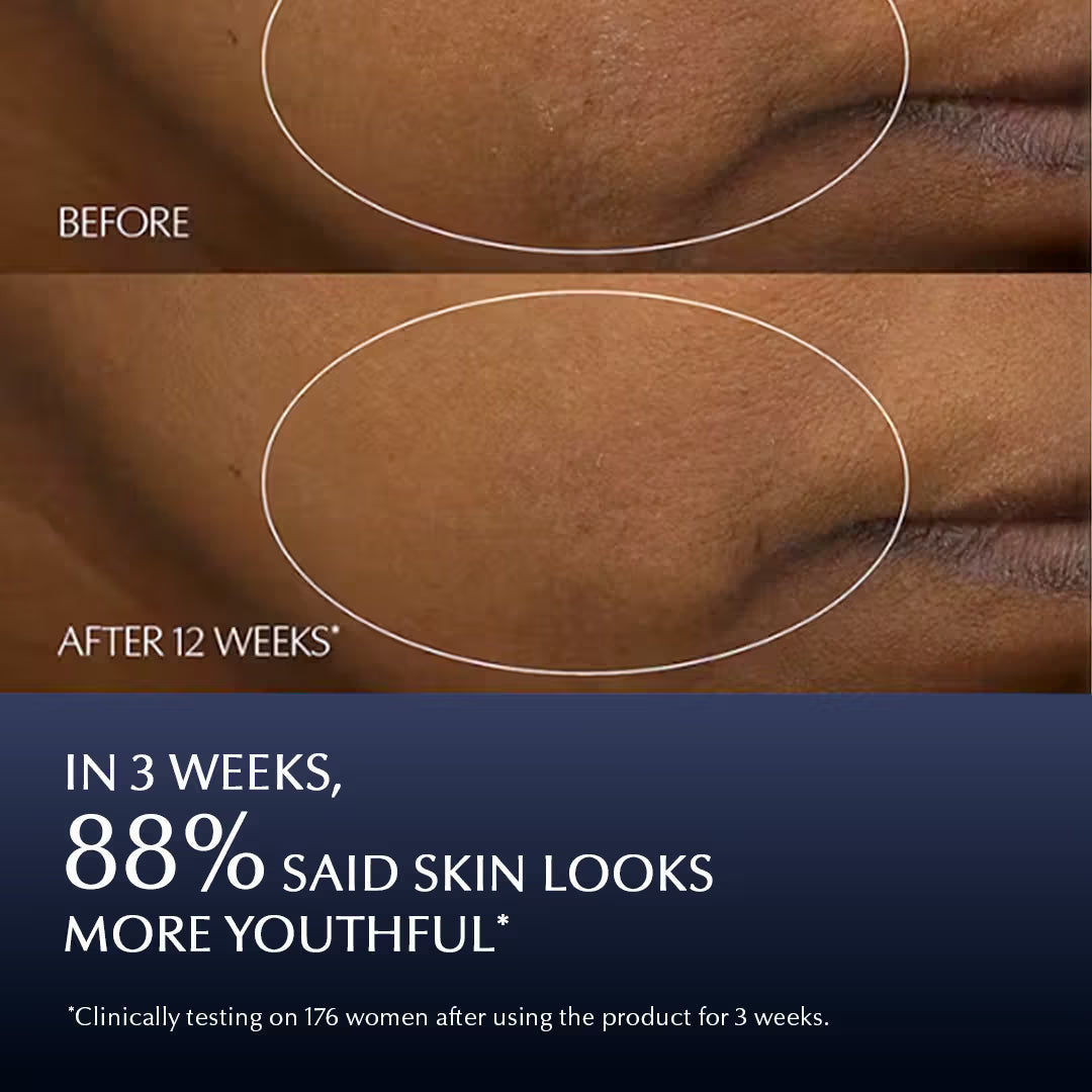 Estee Lauder Advanced Night Repair Synchronized Multi-Recovery Complex | Grocsy