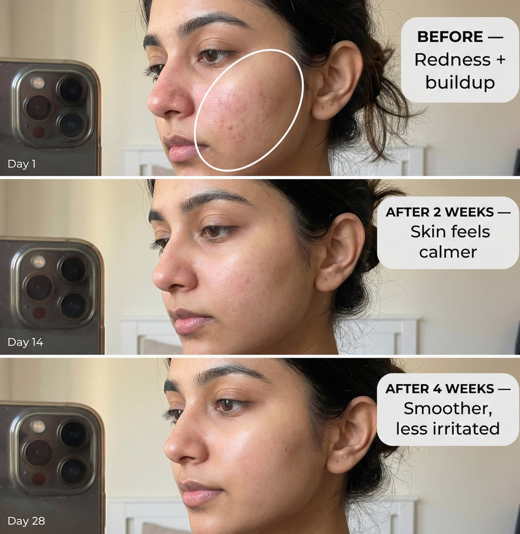 VedicDerm Red Vine Deep Facial Cleanser with Witch Hazel Extract | Grocsy