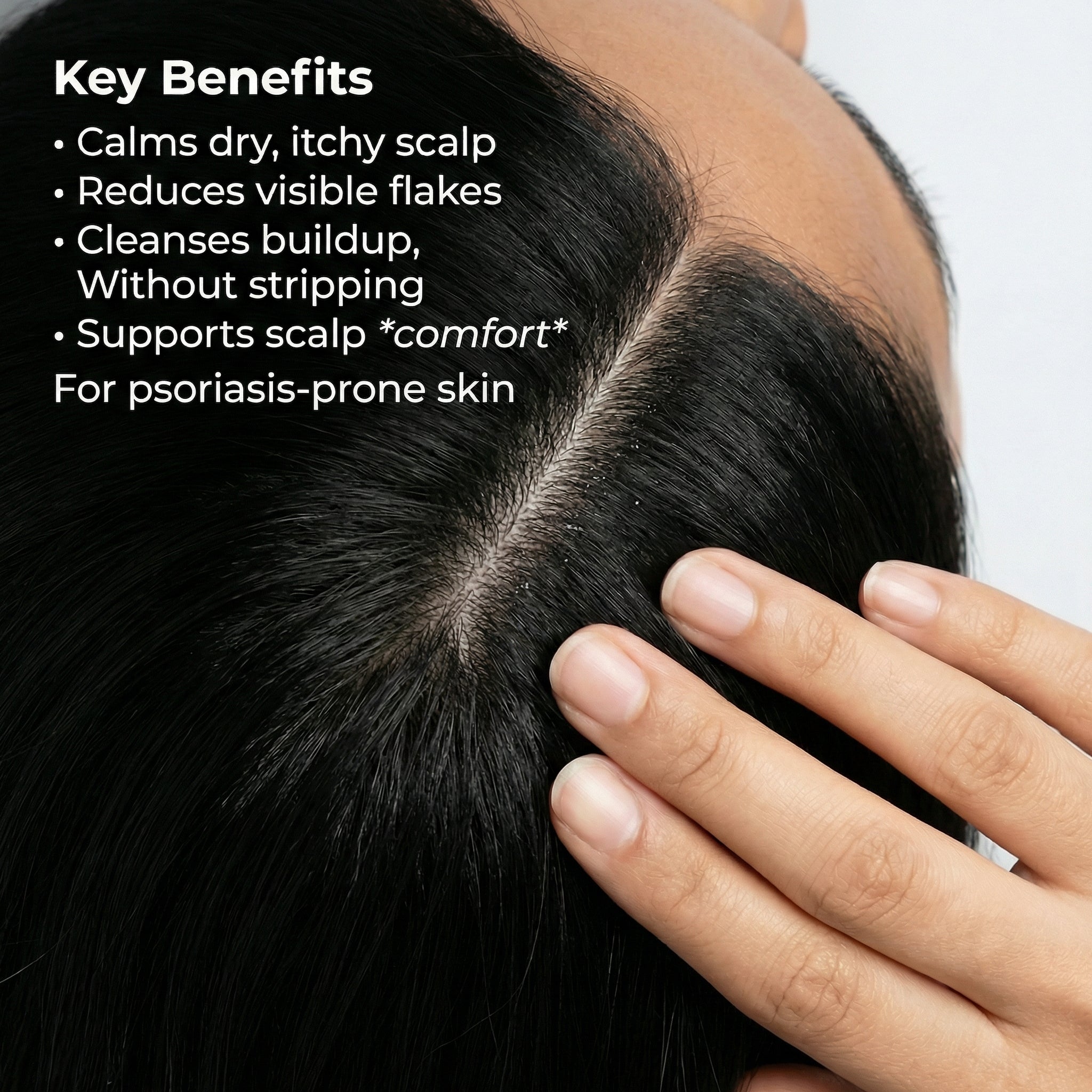 VedicDerm Sensitive Scalp Bundle for Psoriasis, Dandruff, & Itchy Scalp | Grocsy