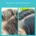 Fable & Mane Sahascalp Amla Soothing Hair Serum For Dry And Sensitive Scalp | Grocsy