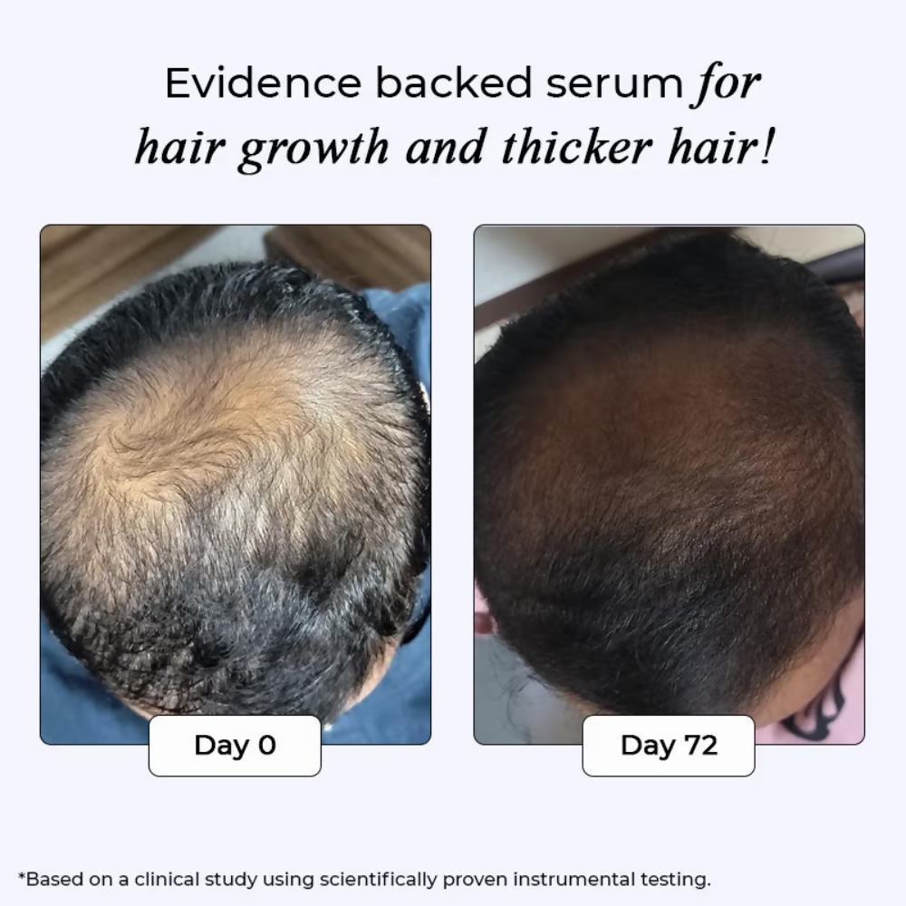 Dr. Su Revive Hair Growth Serum Hairfall Control | Grocsy