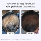 Dr. Su Revive Hair Growth Serum Hairfall Control | Grocsy