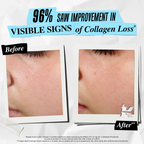 Kiehl's Super Multi - Corrective Soft Cream | Grocsy