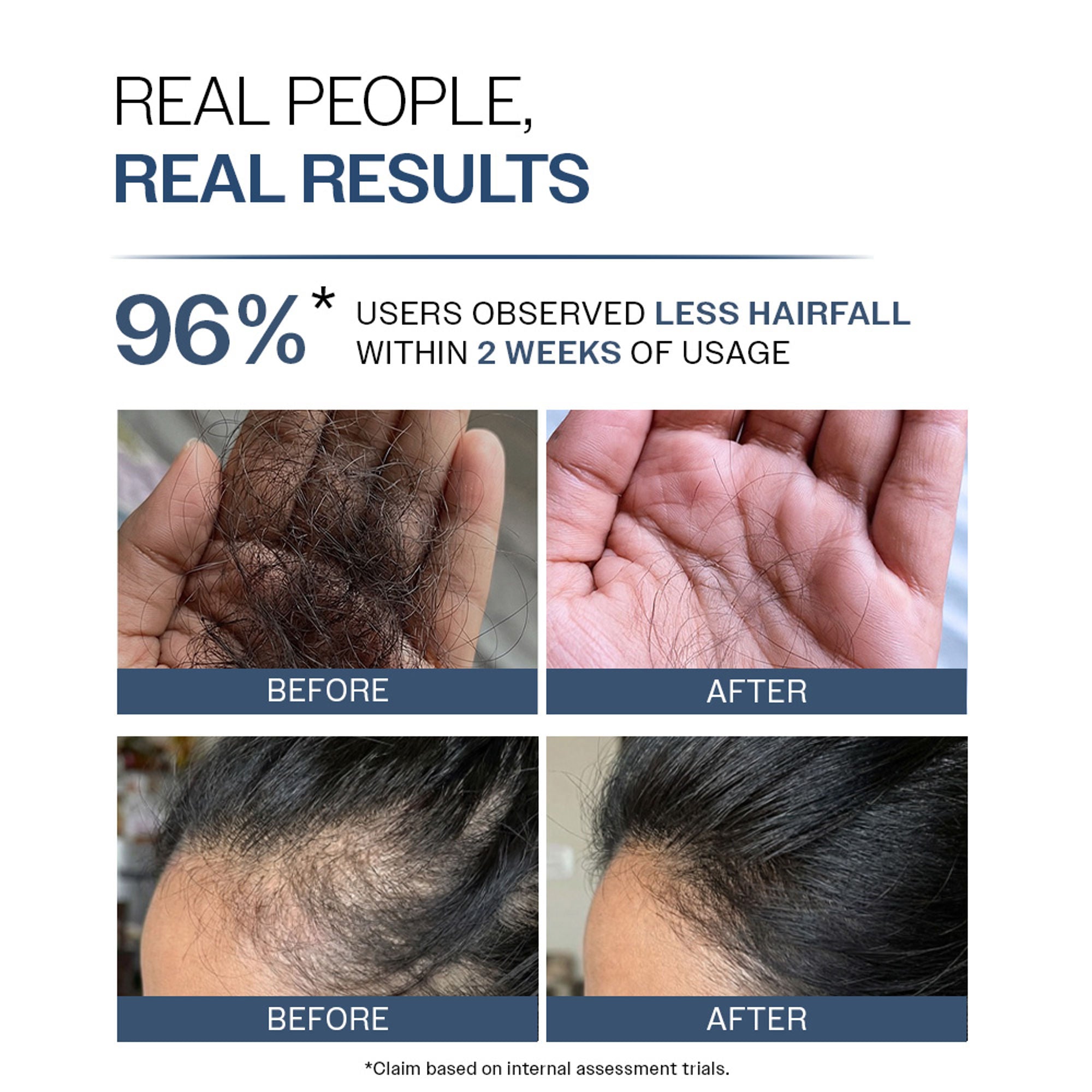 Bare Anatomy Anti-Hair Fall Shampoo 5X Hair Fall Control With Peptides | Grocsy