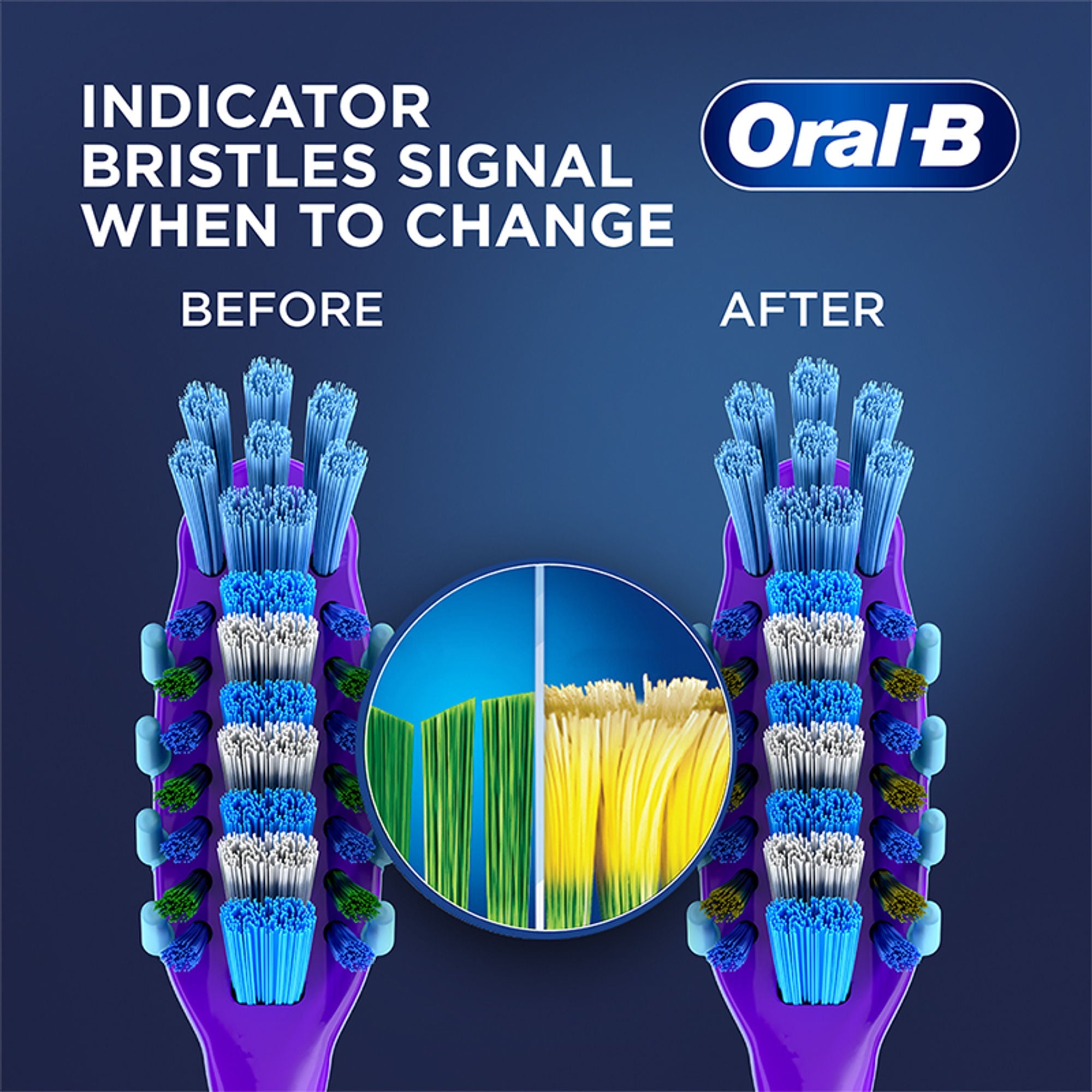 Oral-B Criss Cross Gum Care Toothbrush Buy 2 Get 2 Free (Medium) | Grocsy