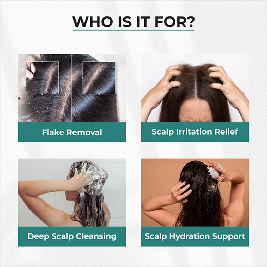 Dr.Sakhiya Anti-Dandruff Shampoo, Itchy Scalp Relief For Men & Women | Grocsy