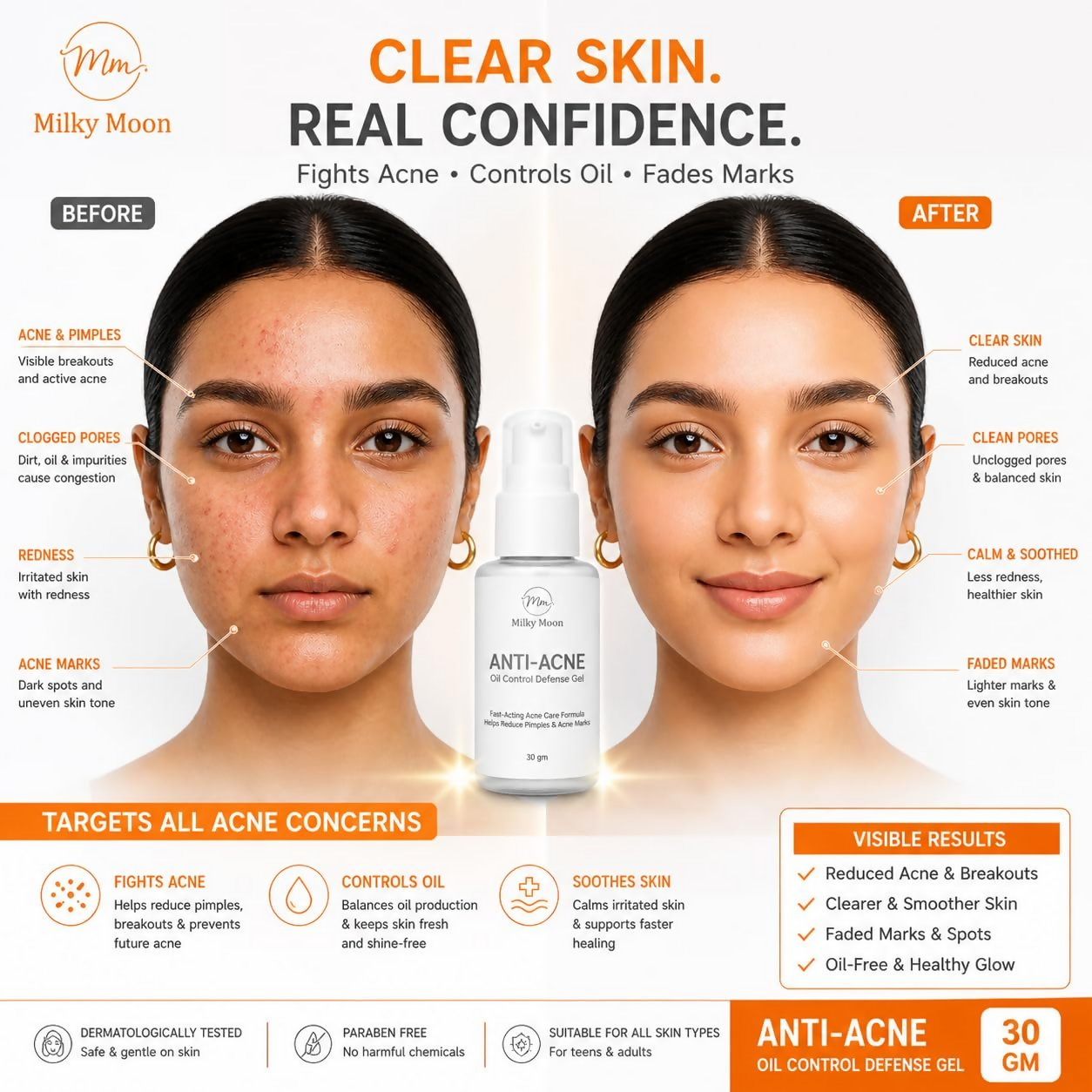 Milky Moon Rapid Relief Anti-Acne Gel | Grocsy