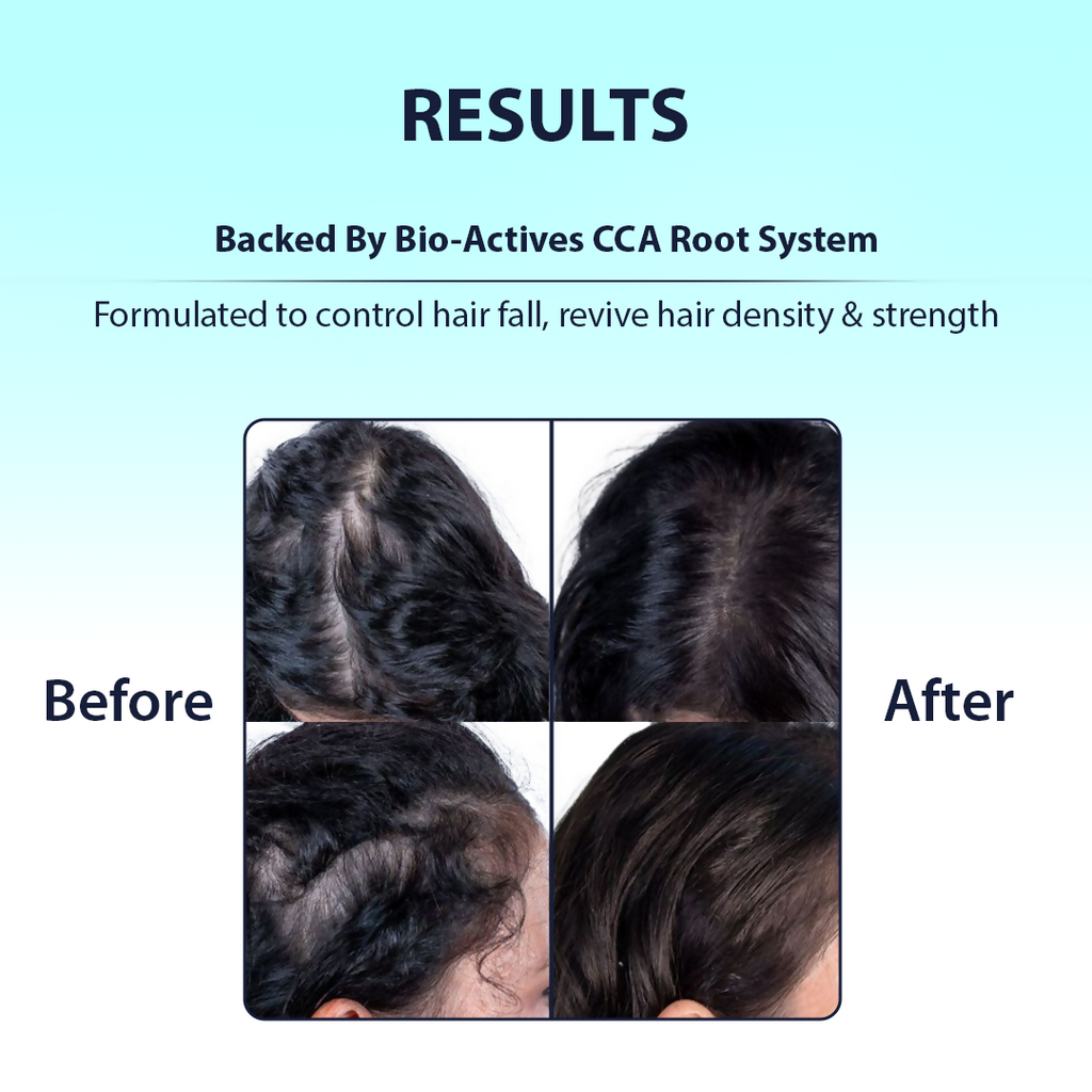 Dermistry Caffeine Collagen Protein Anti-Hair Fall Control Mask | Grocsy