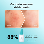 Bella Vita Organic Niacinamide Face Serum | Grocsy