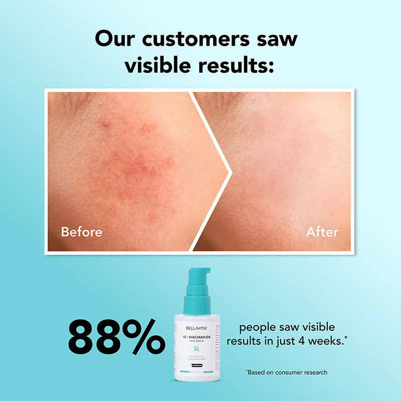 Bella Vita Organic Niacinamide Face Serum | Grocsy