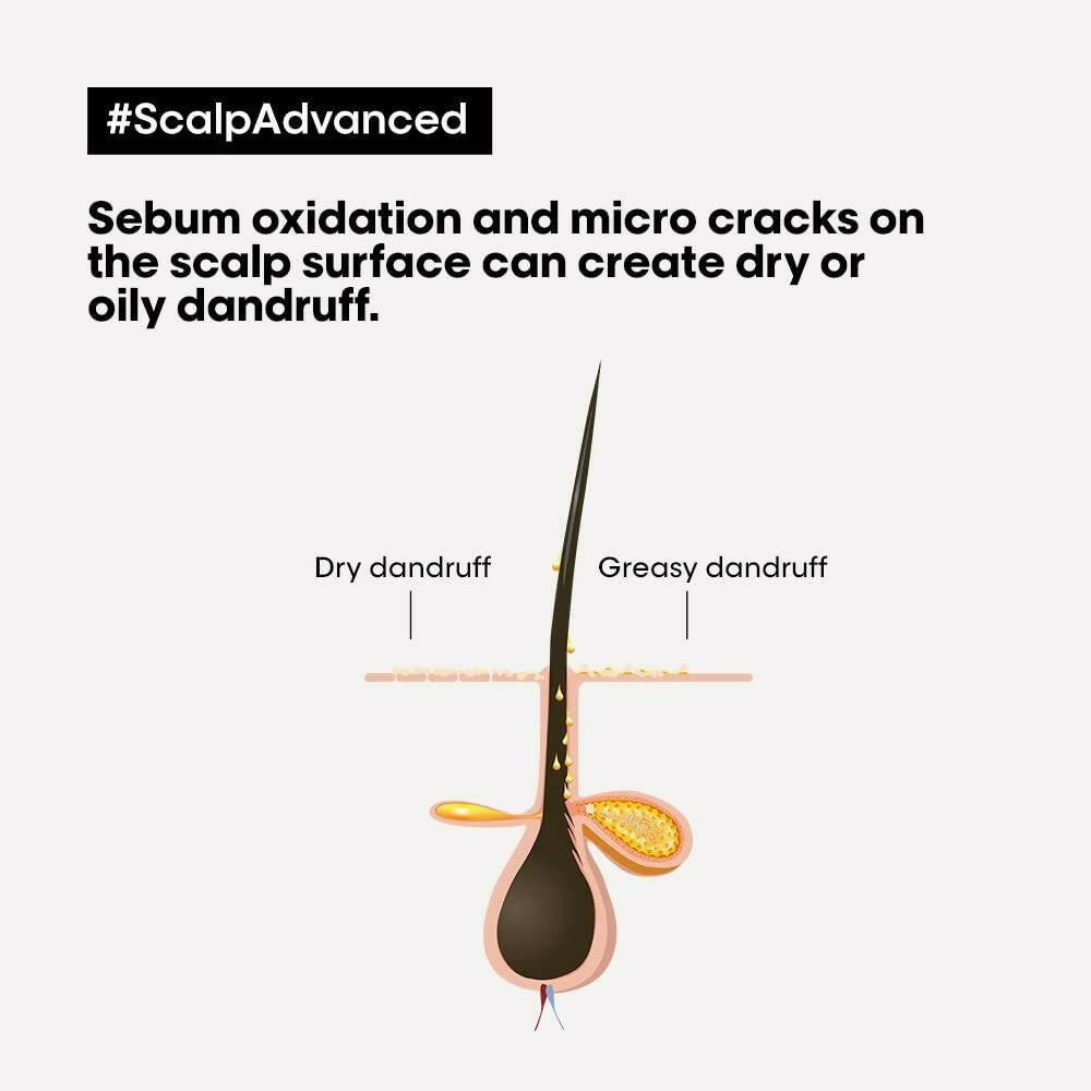 L'Oréal Paris Scalp Advanced Anti-Dandruff Dermo-Clarifier Shampoo & Liss Unlimited Hair Mask | Grocsy