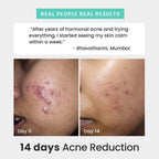 The Solved Skin Rapid Clear Face Wash | Grocsy