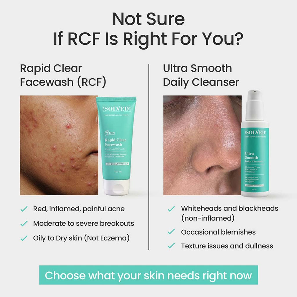 The Solved Skin Rapid Clear Face Wash | Grocsy