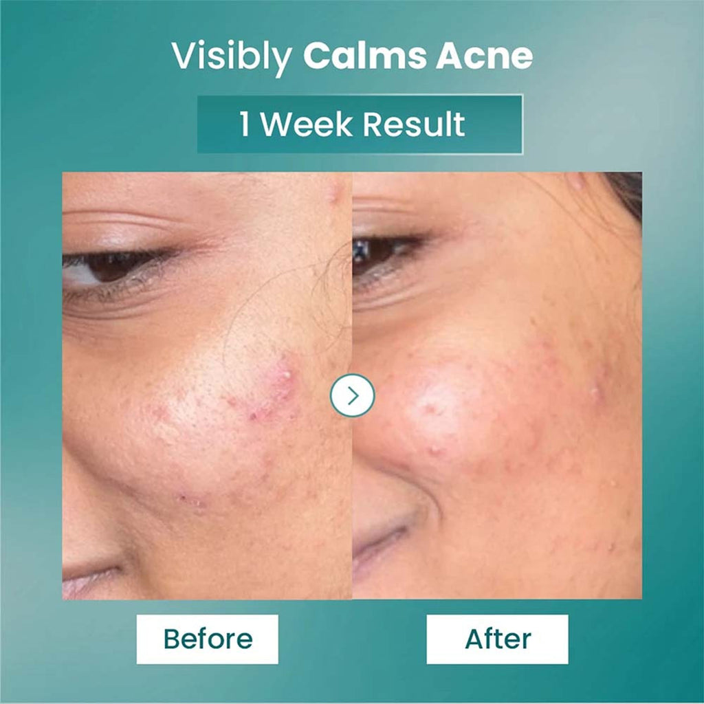 The Solved Skin Spot Fade Advance Repair Serum | Grocsy