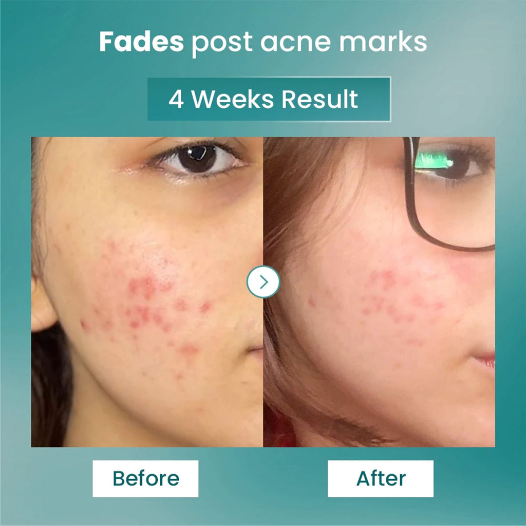 The Solved Skin Spot Fade Advance Repair Serum | Grocsy
