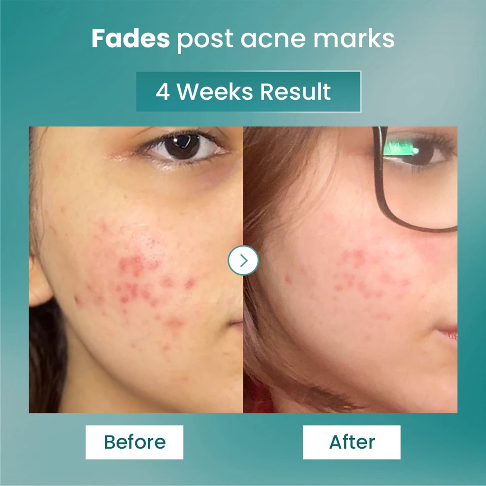 The Solved Skin Spot Fade Advance Repair Serum | Grocsy