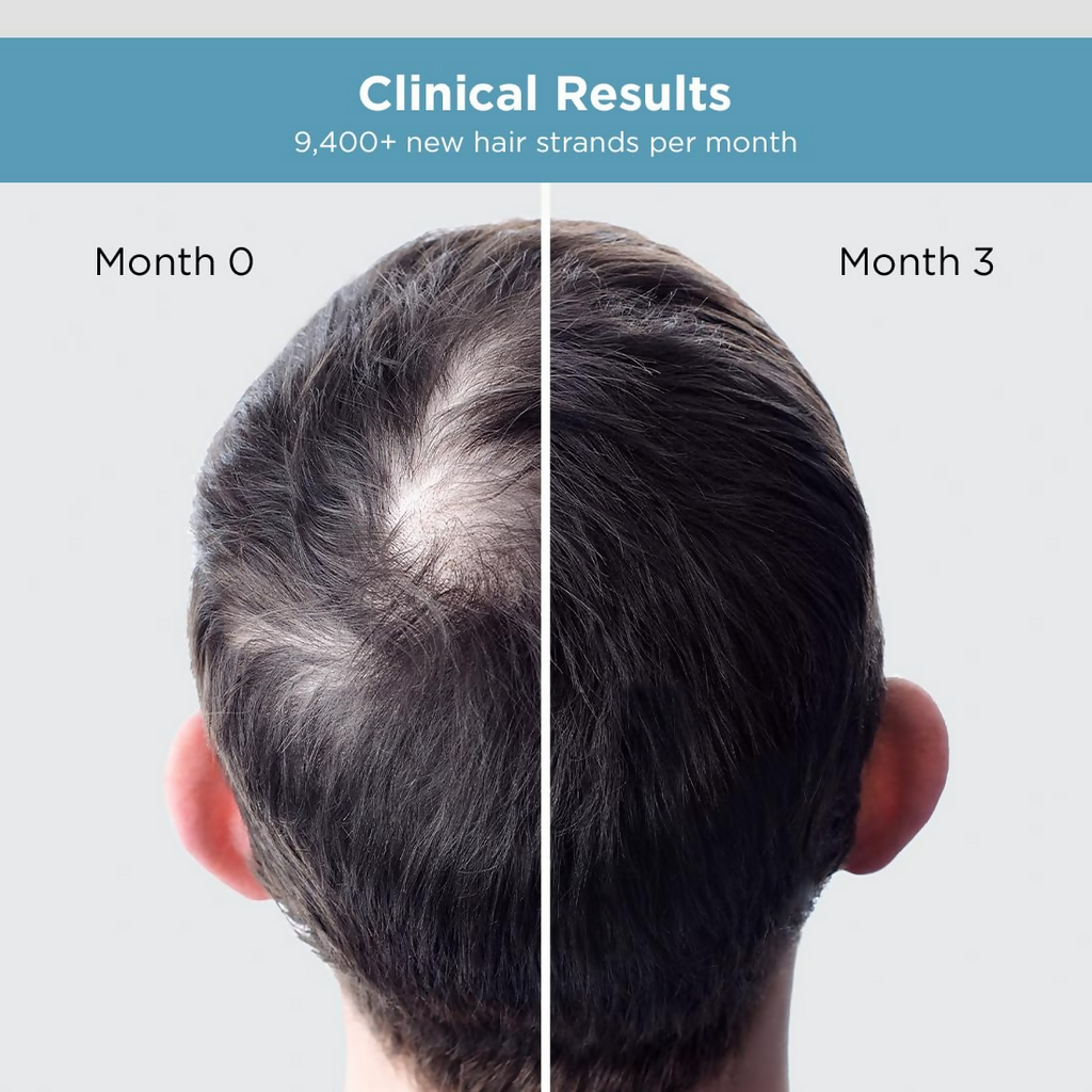 The Man Company Hair Growth Serum For Man | Grocsy