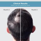 The Man Company Hair Growth Serum For Man | Grocsy