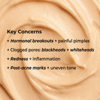 VedicDerm Nano Gold Acne Defence Cream with Turmeric and Nia-Cera-Peptide Complex™️ | Grocsy