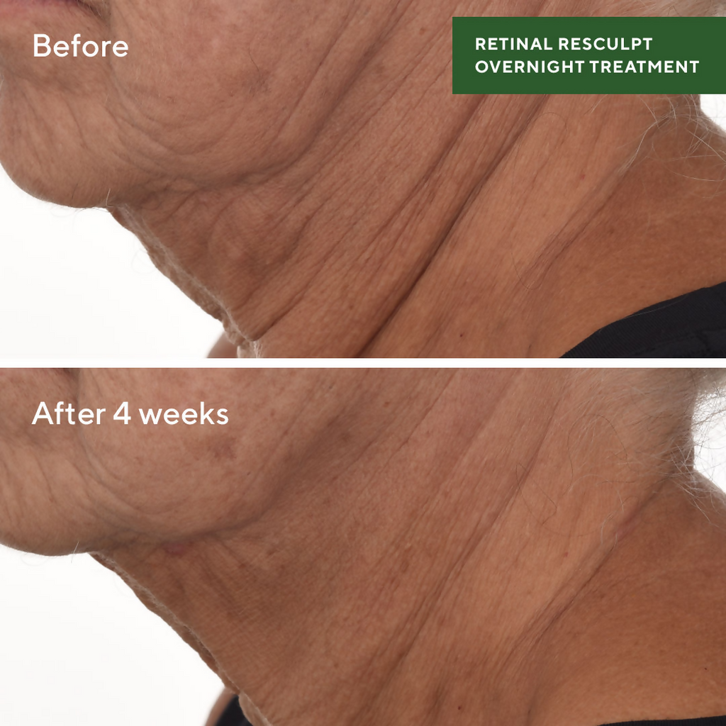 Murad Retinal ReSculpt Overnight Treatment | Grocsy