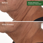 Murad Retinal ReSculpt Overnight Treatment | Grocsy