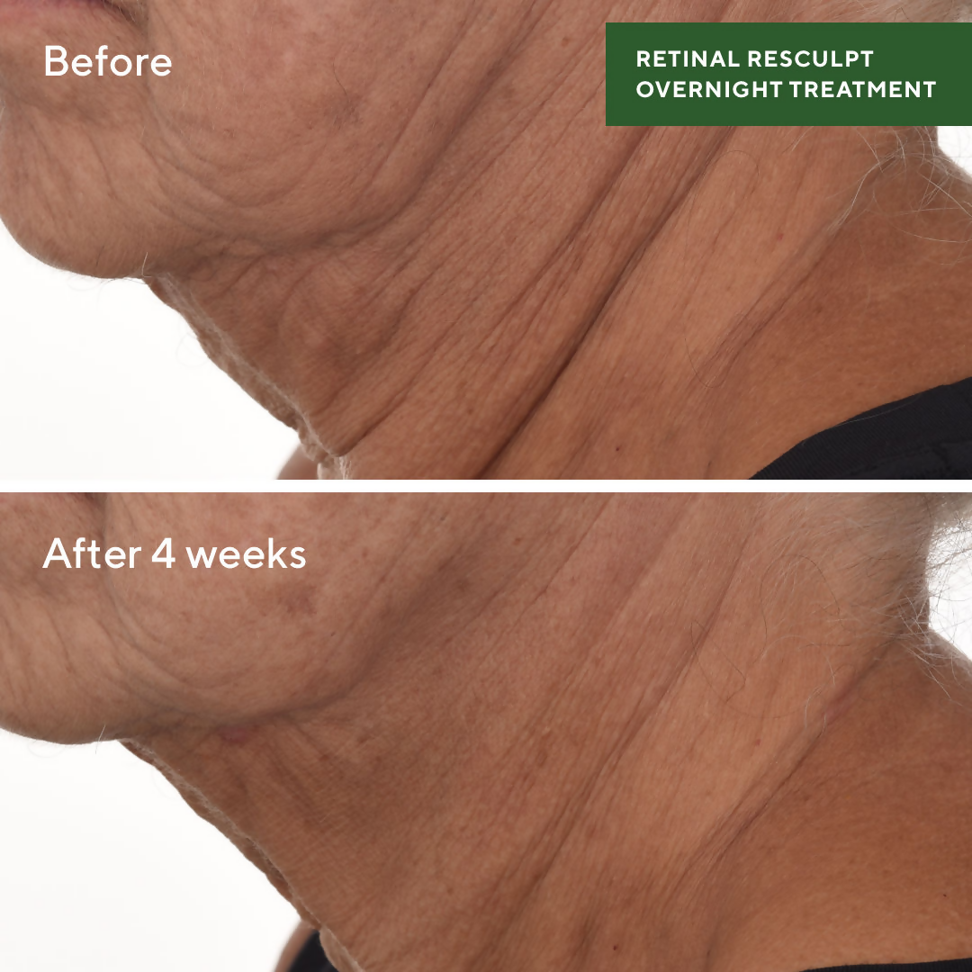 Murad Retinal ReSculpt Overnight Treatment | Grocsy