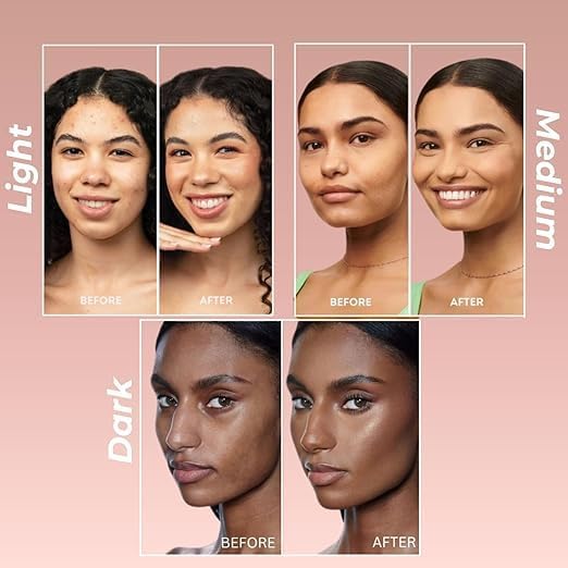 Suroskie My Glow Tinted Moisturizer, 60ml, Medium Shade, SPF 30, With Niacinamide and Natural Extracts | Grocsy