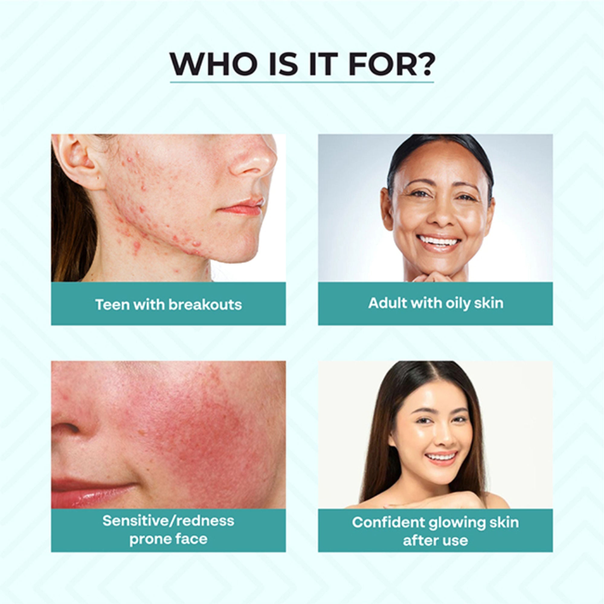 Dr.Sakhiya Acne & Pimple Care Kit | Grocsy
