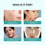 Dr.Sakhiya Acne & Pimple Face Wash | Grocsy
