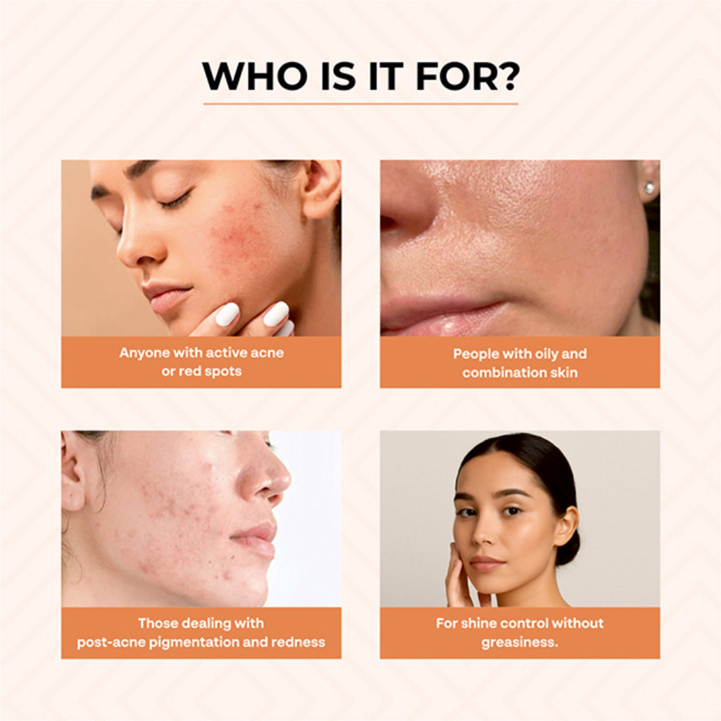Dr.Sakhiya Acne & Pimple Morning Cream | Grocsy
