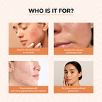 Dr.Sakhiya Acne & Pimple Morning Cream | Grocsy