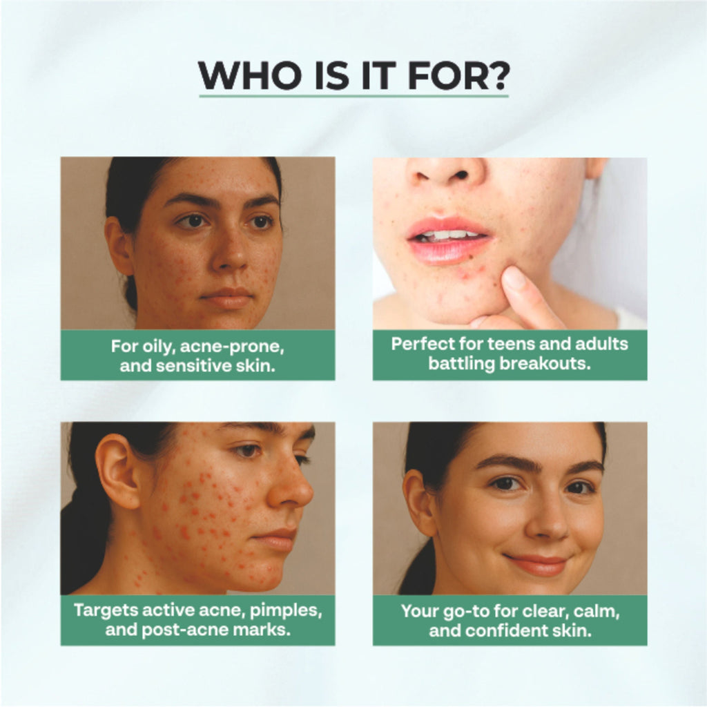 Dr.Sakhiya Acne & Pimple Moisturizer | Grocsy