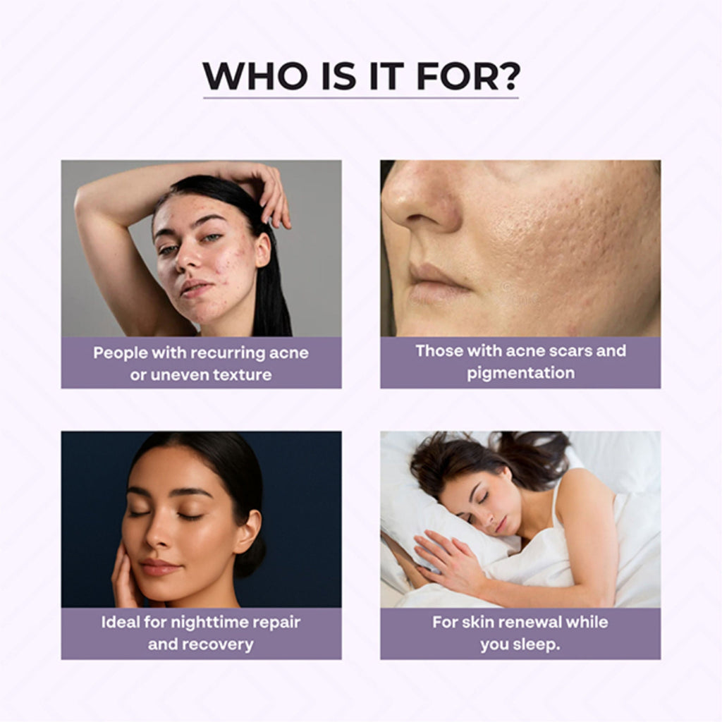 Dr.Sakhiya Acne & Pimple Night Cream | Grocsy