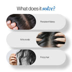 BeBodywise ZPTO Anti Dandruff Shampoo - Reduces Dandruff, Flaking & Deeply Hydrates Scalp | Grocsy