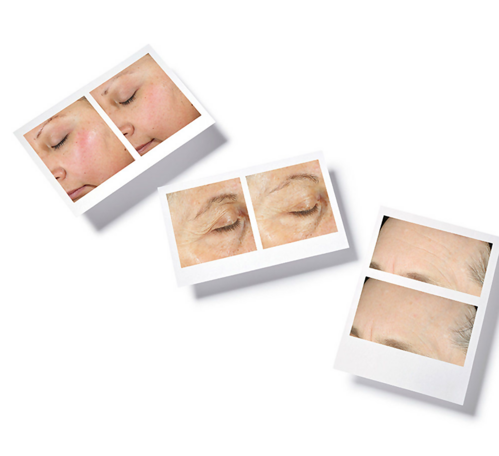 Murad Hydration Intense Recovery Cream | Grocsy